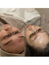 ロミエール 守山店(LOMIERE)/40.50代人気!セルマン　¥11,000