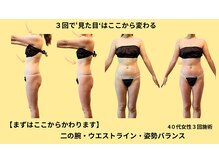 プライベートサロン やすらぎ/症例写真｜エンダモロジー×姿勢