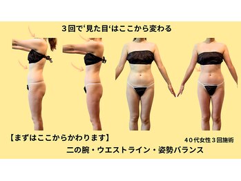 プライベートサロン やすらぎ/症例写真｜エンダモロジー×姿勢