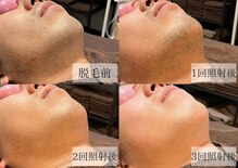 メンズアルファ