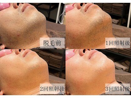 メンズアルファの写真