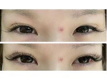 リーベアイラッシュ 東久留米店(Liebe eyelash)/ボリュームラッシュ400本