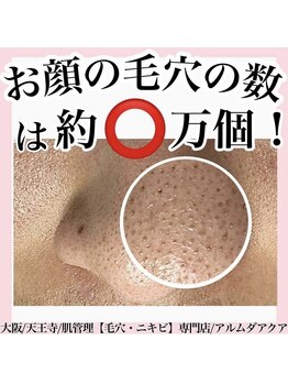 アルムダアクア 天王寺店(Aleumda AQUA)/毛穴エクストラクションプロ大阪