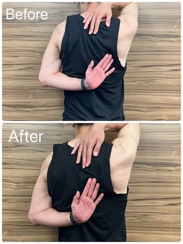 サロン ド レーヴ(Salon de Reve)/【お客様の事例】Billy’s Care