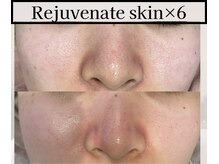 ミックスアップ 池袋店(Mix up!!)/フェイシャル技術の効果