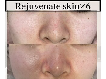 ミックスアップ 池袋店(Mix up!!)/フェイシャル技術の効果