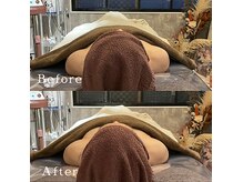 ブリリアントライフ(Blilyant life)の雰囲気（美zenフェイシャルトリートメント Before&After）