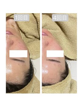 トランク(Trunk)/プラズマ♪before→after