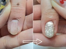 ニコネイル 本厚木(nico.nail)の雰囲気（巻き爪、リペア、長さ出しなどネイルケアも◎本厚木/本厚木駅）