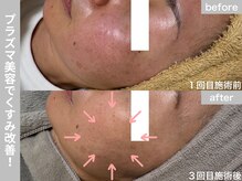 サロン ビュー(salon view)/40代女性〈くすみ悩み〉　