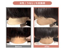 HGB 東山公園駅前店/女性｜30代｜主婦