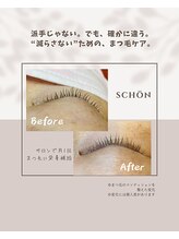 シェーン(schon)/サロンで月1回栄養補給