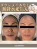 No.1【速攻性◎ツヤ肌♪】無針水光注入+水素毛穴洗浄本格肌改善プログラム