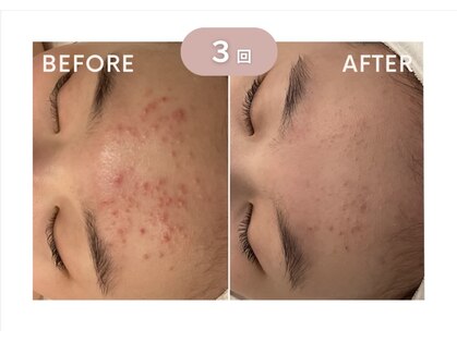 ユーフォリアファステ シルキーメンズ(Euphoria Faste Silky Men's)の写真