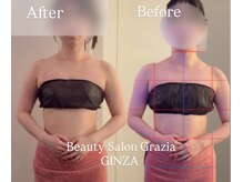 グラツィア 銀座(Grazia)/体験1回 [ブライダルエステ整体]