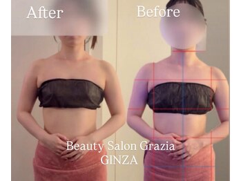 グラツィア 銀座(Grazia)/体験1回 [ブライダルエステ整体]