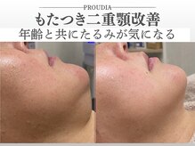 プラウディア(PROUDIA)の雰囲気（ボディハーブピーリング/背中ハーブ/ニキビケア/毛穴ケア/シミ）