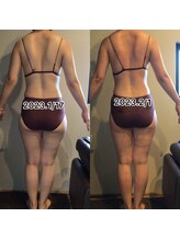 エスデザイン(es design)/デトックス痩身／谷山エステ