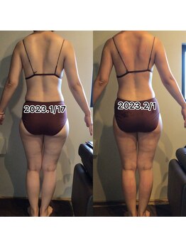 エスデザイン(es design)/デトックス痩身/谷山エステ