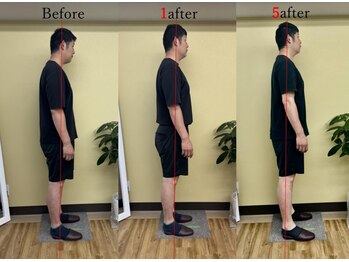 アプロ(APLO)/自律神経調整+姿勢矯正