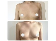 ミミーの雰囲気(希少な乳腺マッサージで脂肪細胞UP。定着しやすいバストに。)