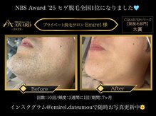 エミレル(Emirel)の雰囲気（ヒゲ脱毛にかなりの自信あり◎結果第一のサロンです☆）