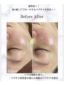 プラスベル(plus Belle)/縦シワ横シワ軽減、艶ハリ爆誕