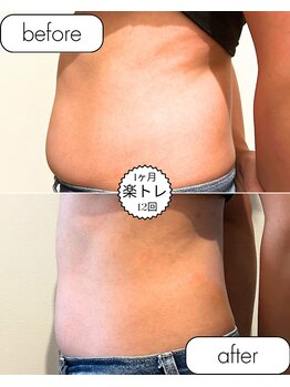 ゼロプラス(ZERO+)/【引き締め】1カ月の記録!