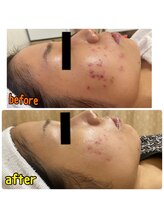 ビズビズ(bisebise)/