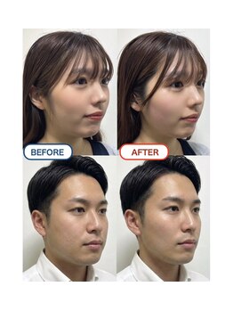 ヘッドミントVIP 銀座店の写真/完全都度払い★小顔矯正コルギ　頭皮から引き上げる小顔矯正！脳疲労も顔むくみもスッキリ！