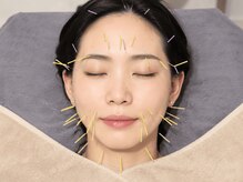 ビハリスト 麻布十番の雰囲気(初回施術は、お顔全体の美容鍼を行い、施術前と後の効果を実感)