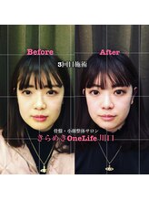 きらめき ワンライフ 川口(One Life)/小顔矯正BeforeAfter３