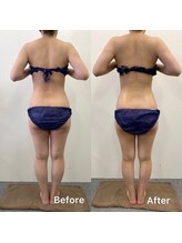 きれい塾 恵比寿/40代一回施術後