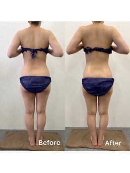 きれい塾 恵比寿/40代一回施術後