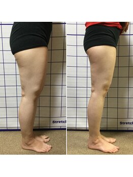 アリス フィットネスサロン/*施術効果*