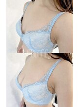 フラフィ 宇都宮本店(fluffy)/デコルテの削げが気になるお客様