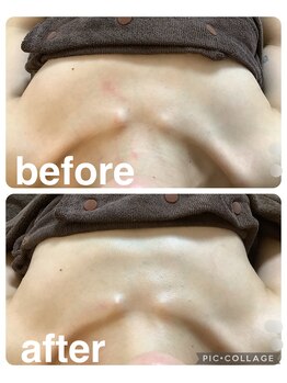 ギンザアール(GINZA R.)/バストケア♪