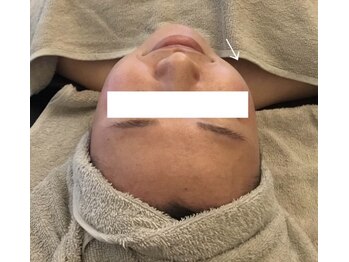 サロン ワン(salon one)/リフトアップ