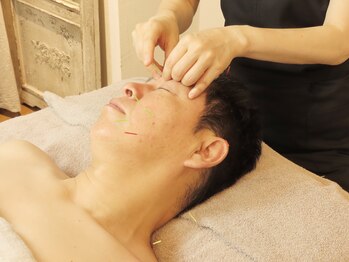 クランシュプール恵比寿鍼灸院/メンズ人気 美容鍼とお悩み別