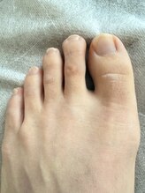 トッコ 清澄白河店(tocco)/そうだ脱毛へ行こう