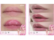 ビューティーツリー(Beauty Tree)