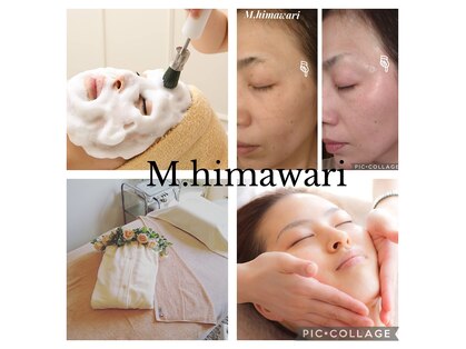 エムヒマワリ(M.himawari)の写真