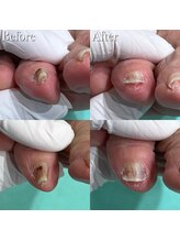 巻き爪補正店 横浜駅前店/