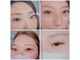ラヴィエール(Laviere)の写真