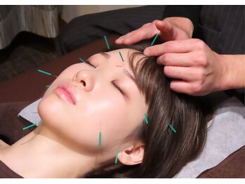 円山よもぎ鍼灸整骨院/美容鍼【ヘッドマッサージ付き】