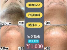 エクレ 今池店(EKURE)