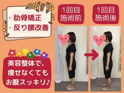 リジューブ(Rejuve)の写真