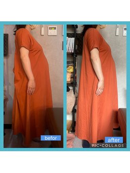 デリマ(Delima)/マタニティアロマ