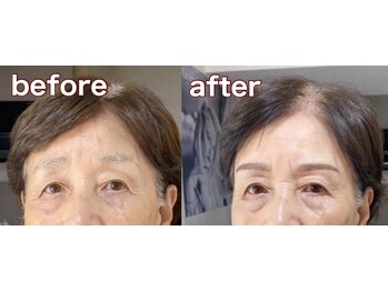 美ラボ リッチエンジェル/美眉で叶うデザイン眉