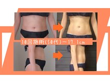 お腹もスパルタ!! 次はあなたの番です!!【町田】